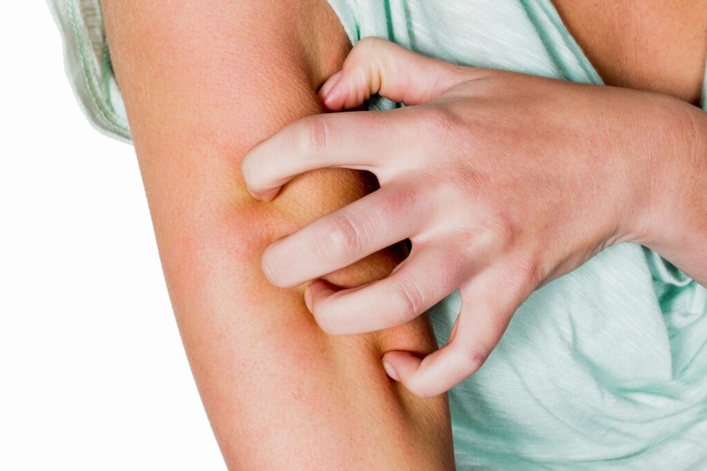 Аллергия на коже - причины, симптомы и методы лечения