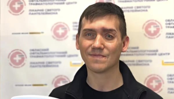 Волонтер з екзопротезом на обличчі: Люди не помічають, що в мене немає&hellip;