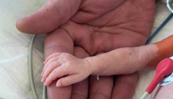 В Інституті серця успішно прооперували немовля вагою 1100 грамів